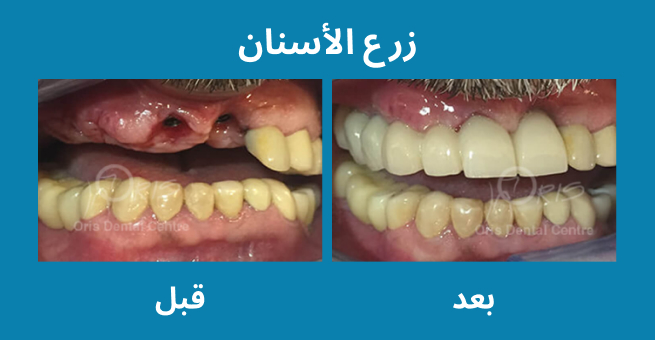 معرض الابتسامة  