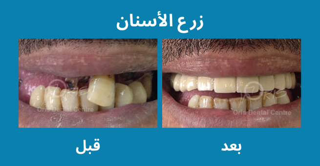 معرض الابتسامة