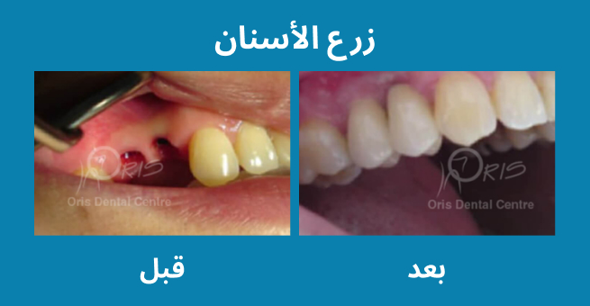 معرض الابتسامة