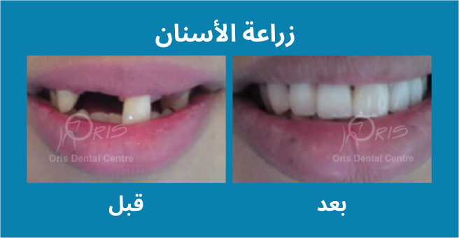 معرض الابتسامة