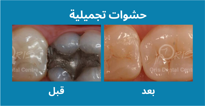 معرض الابتسامة  