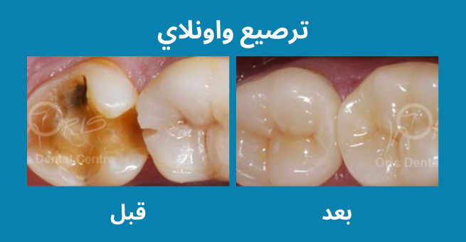 معرض الابتسامة