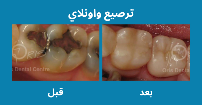 معرض الابتسامة