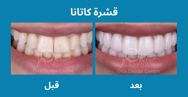 معرض الابتسامة  