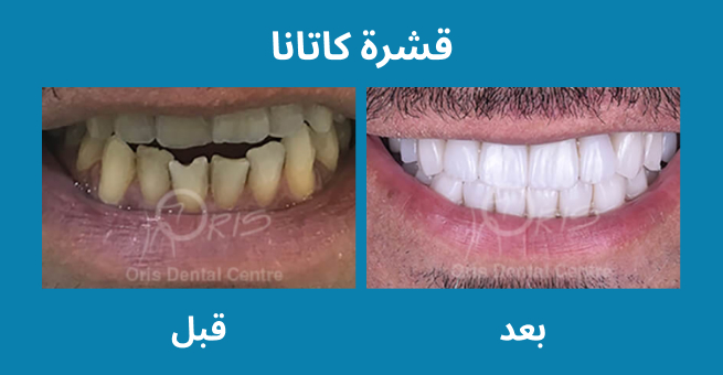 معرض الابتسامة