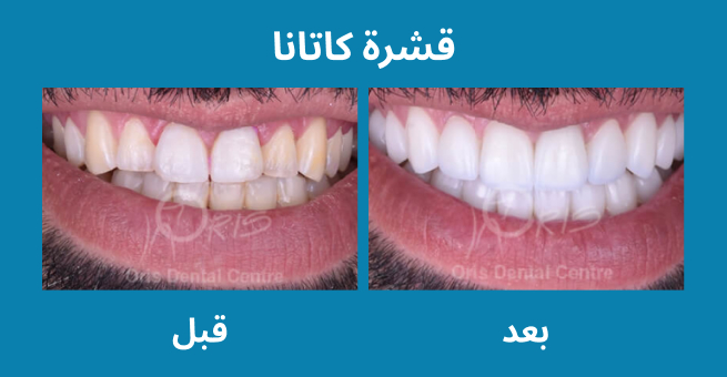 معرض الابتسامة