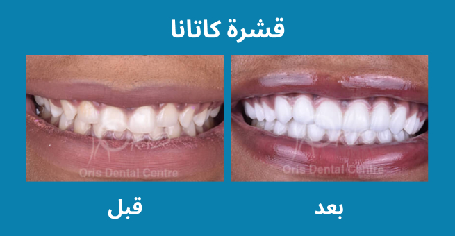 معرض الابتسامة