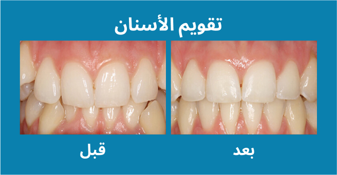 معرض الابتسامة  
