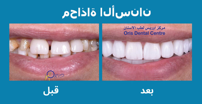 معرض الابتسامة  