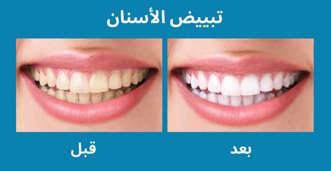 معرض الابتسامة  