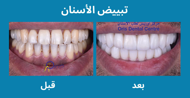 معرض الابتسامة  