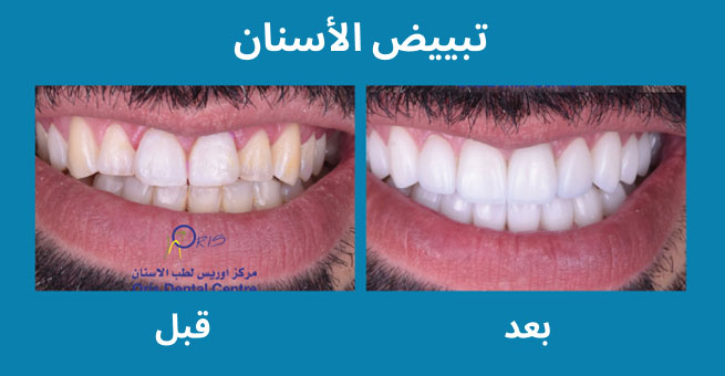 معرض الابتسامة  