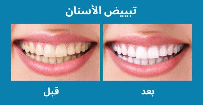 معرض الابتسامة  