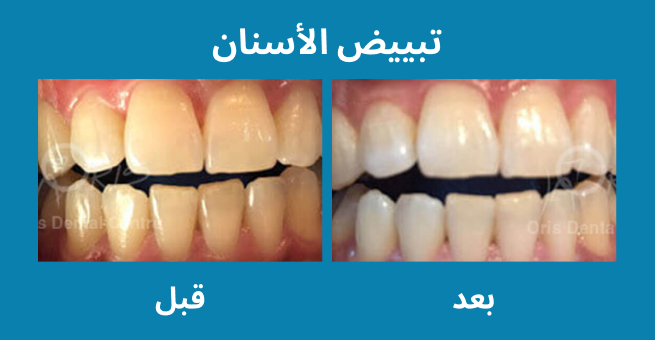 معرض الابتسامة