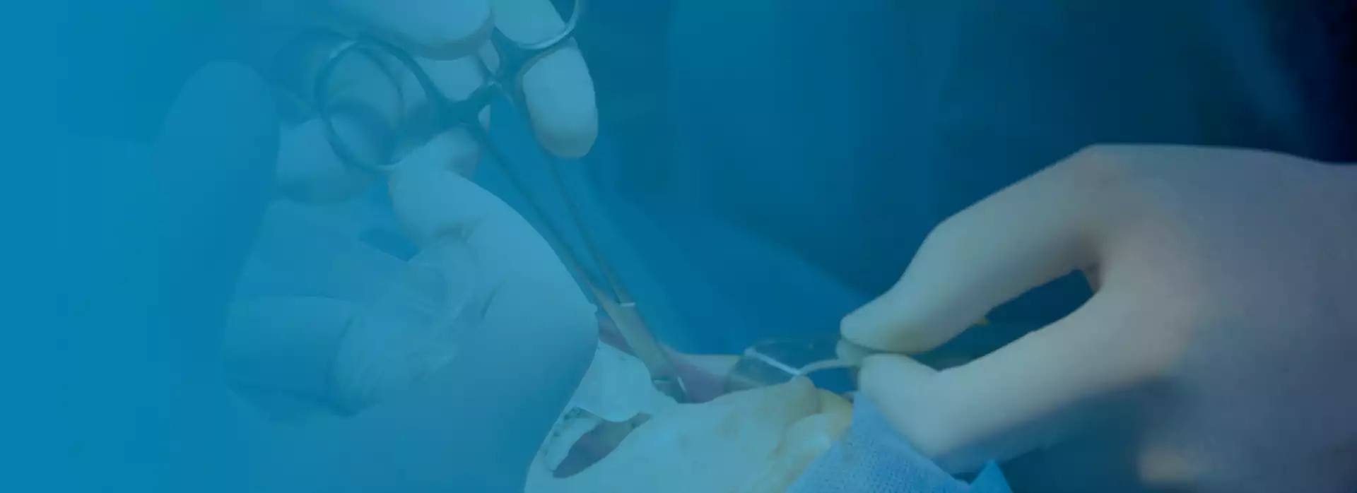 Surgical Tooth Extraction