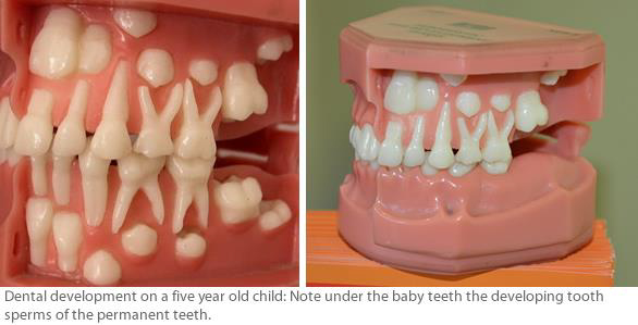 Miniature of baby teeth and permanent teeth beneath them