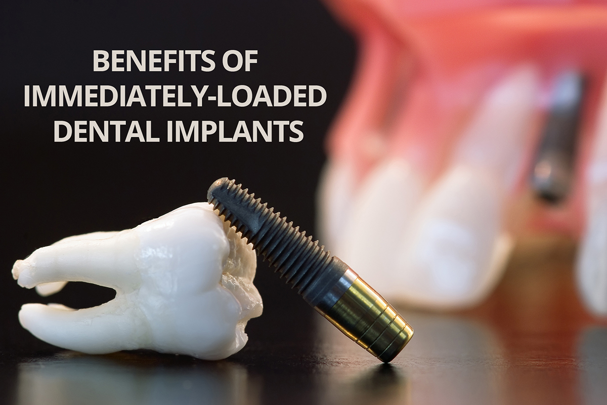 Single Dental Implant