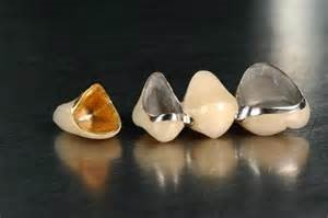 Metal Crowns