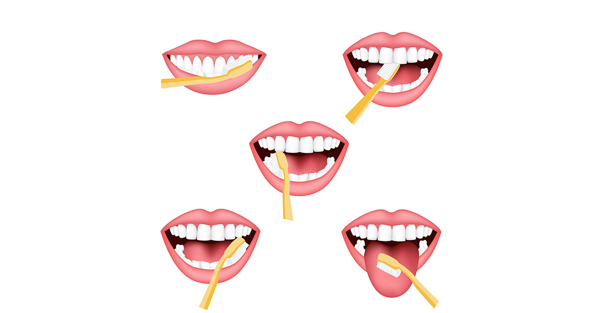 Pointers to brushing your teeth correctly | Dental clinic in Dubai