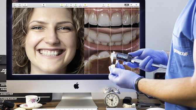 Digital smile design for Dental aesthetics