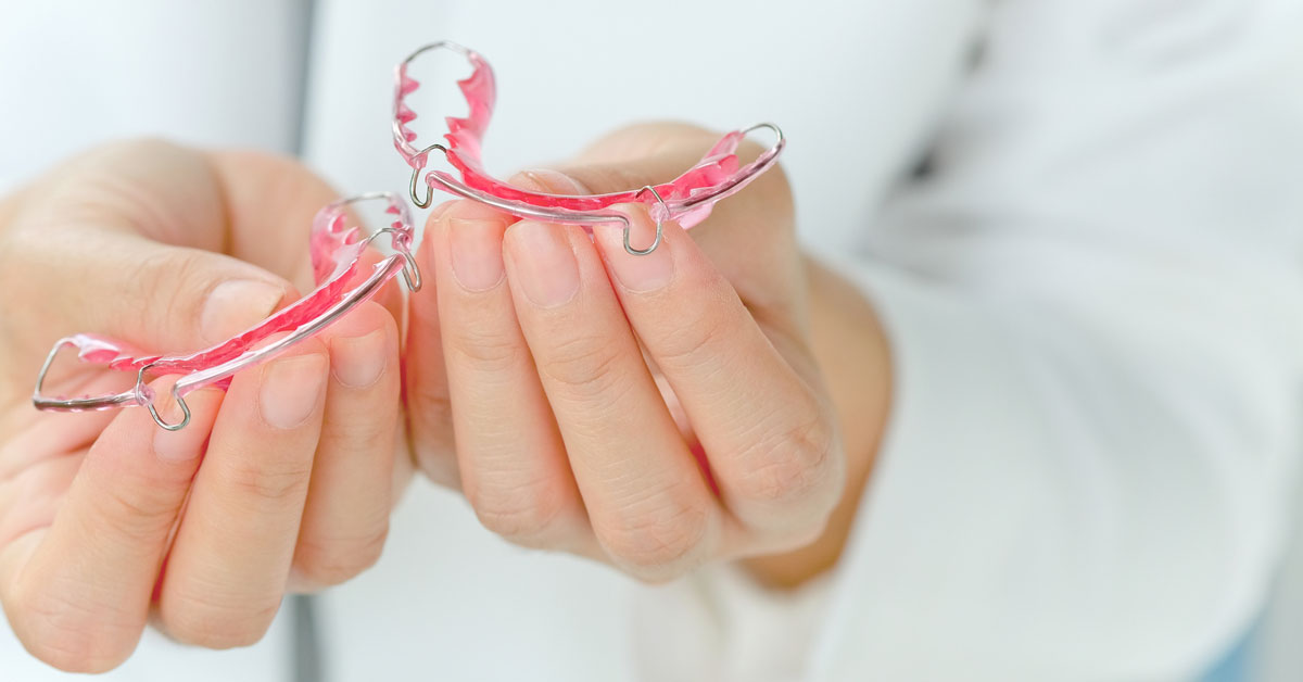 Orthodontic retainers – Their role and importance | orthodontics In Dubai