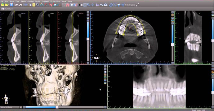 digital dentistry