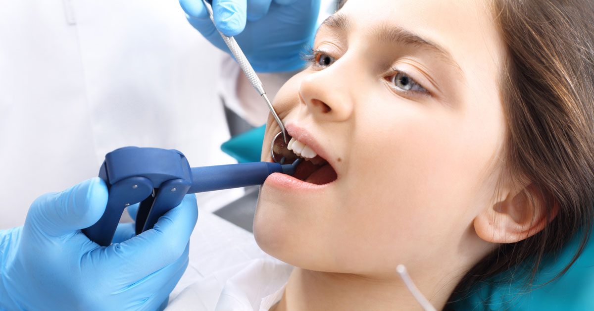 Dental Sealants – Their importance in young teeth