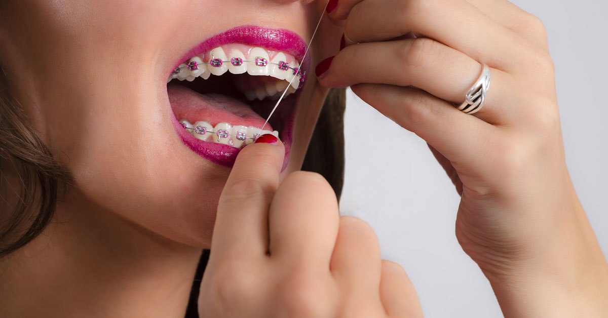 flossing teeth with braces