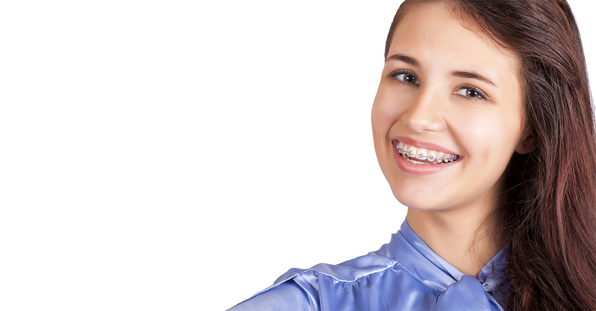 Orthodontic bonding of Braces – How long is the Process | Orthodontics In Dubai