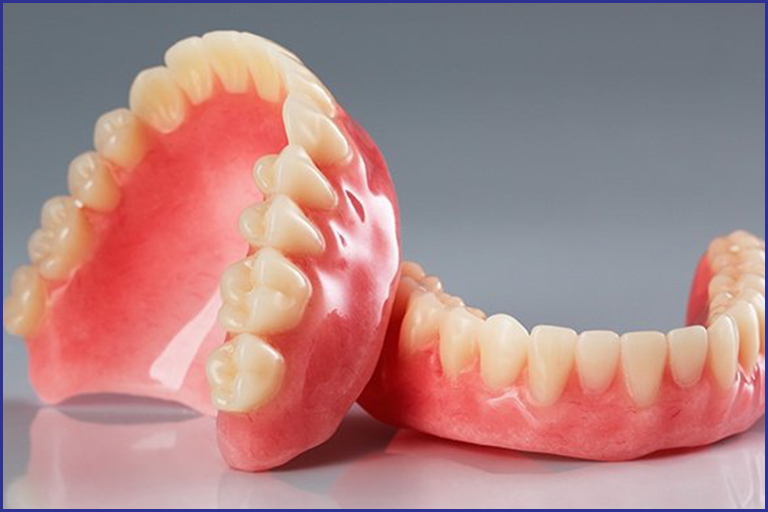 Why implant supported dentures are worth consideration?