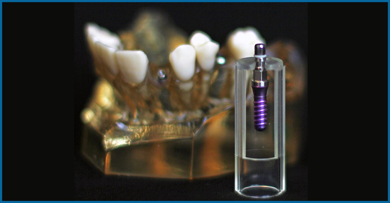 dental implants screw