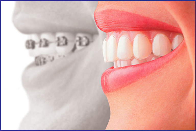 Dentistry in Dubai: Medical Insurance, Medical Tourism & Offers