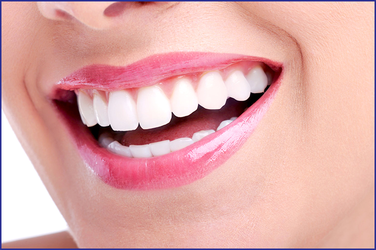 teeth whitening dubai