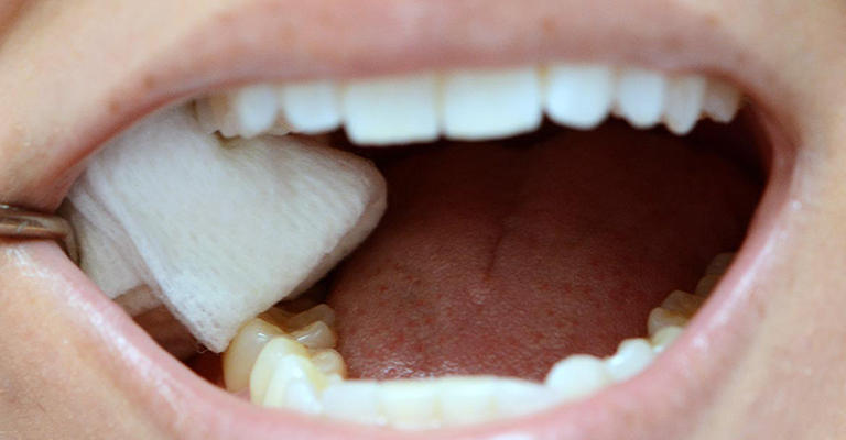 Gauze in mouth