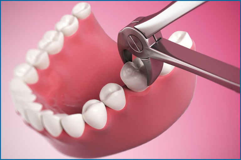 Dentistry in Dubai: Medical Insurance, Medical Tourism & Offers