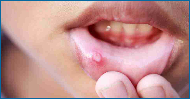 minor soft tissue injury
