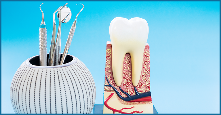 diagnosis of osteitis