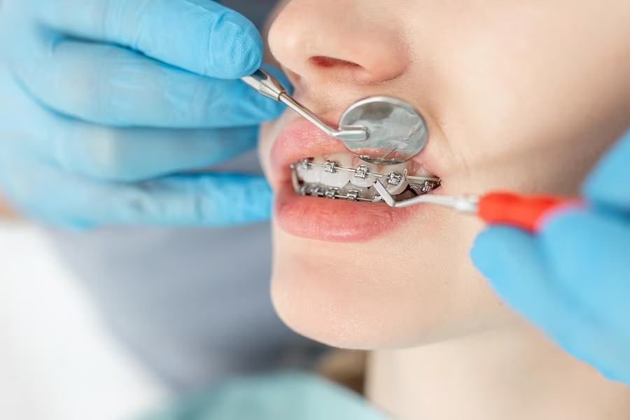 Dentistry in Dubai: Medical Insurance, Medical Tourism & Offers