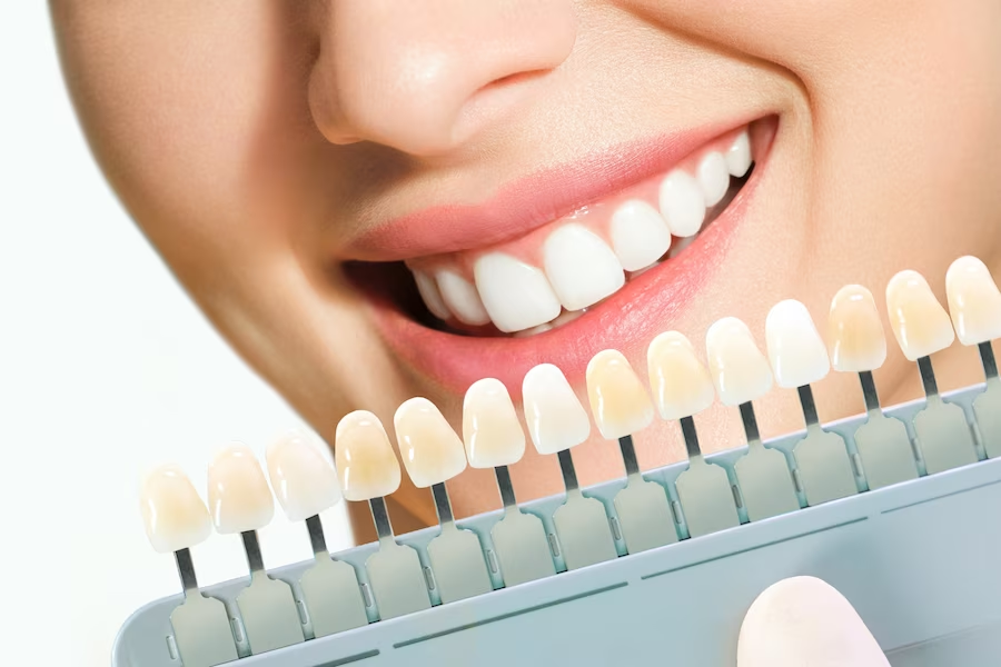 Dentistry in Dubai: Medical Insurance, Medical Tourism & Offers