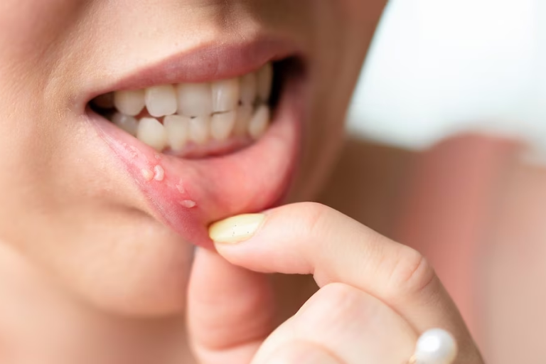 How Do You Treat a Bad Taste in Your Mouth?