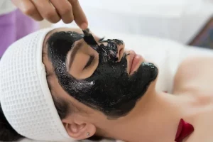 Carbon Laser Peel in Dubai