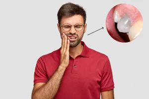 Dead Tooth