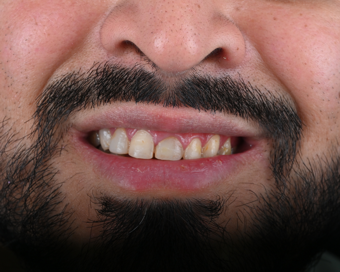 After Image