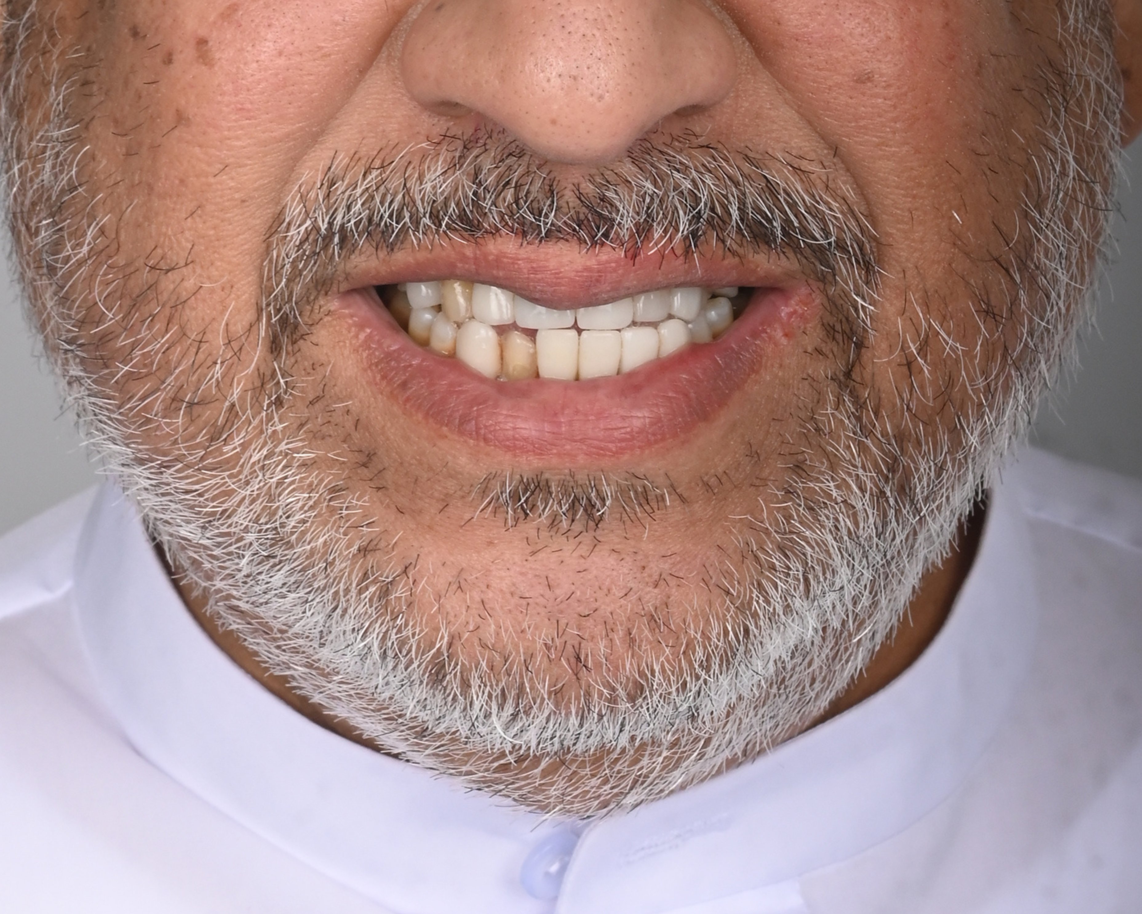 After Image