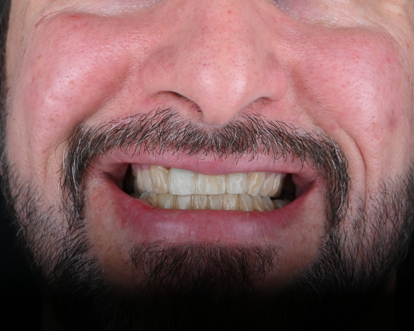 After Image