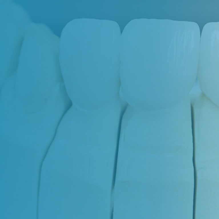 KATANA Zirconia Crown Oris Dental Center