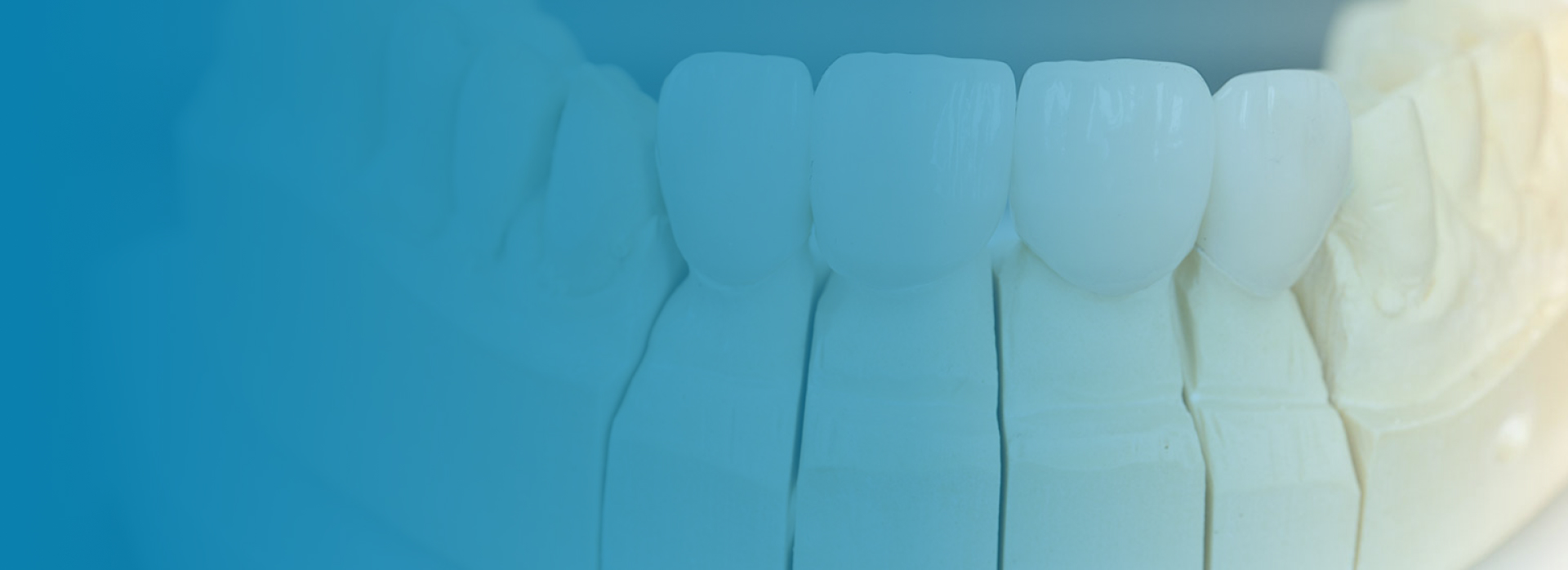 KATANA Zirconia Crown Oris Dental Center