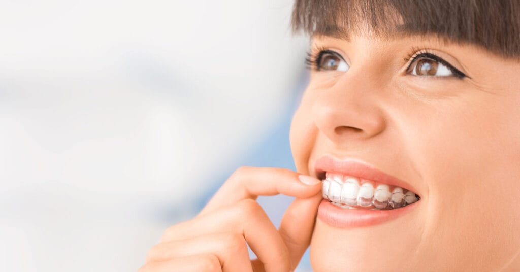 How to Care For Your Smile after Invisalign Procedure | Orthodontics In Dubai