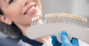 Porcelain veneers – A Clearer understanding | Porcelain Veneers In Dubai