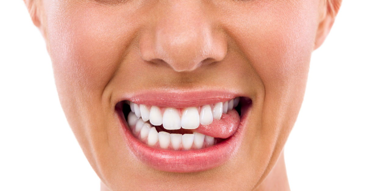 Possible problems and outcome of an under-bite - Oris Dental Center